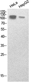 SREBP1 Rabbit Polyclonal Antibody