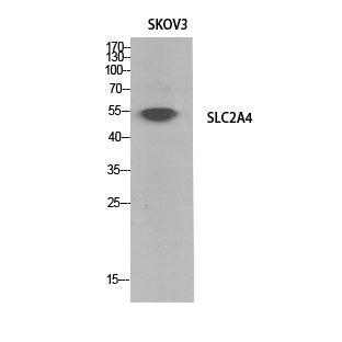 Glucose Transporter GLUT4 Rabbit Polyclonal Antibody