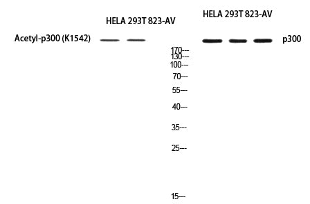 p300 Rabbit Polyclonal Antibody