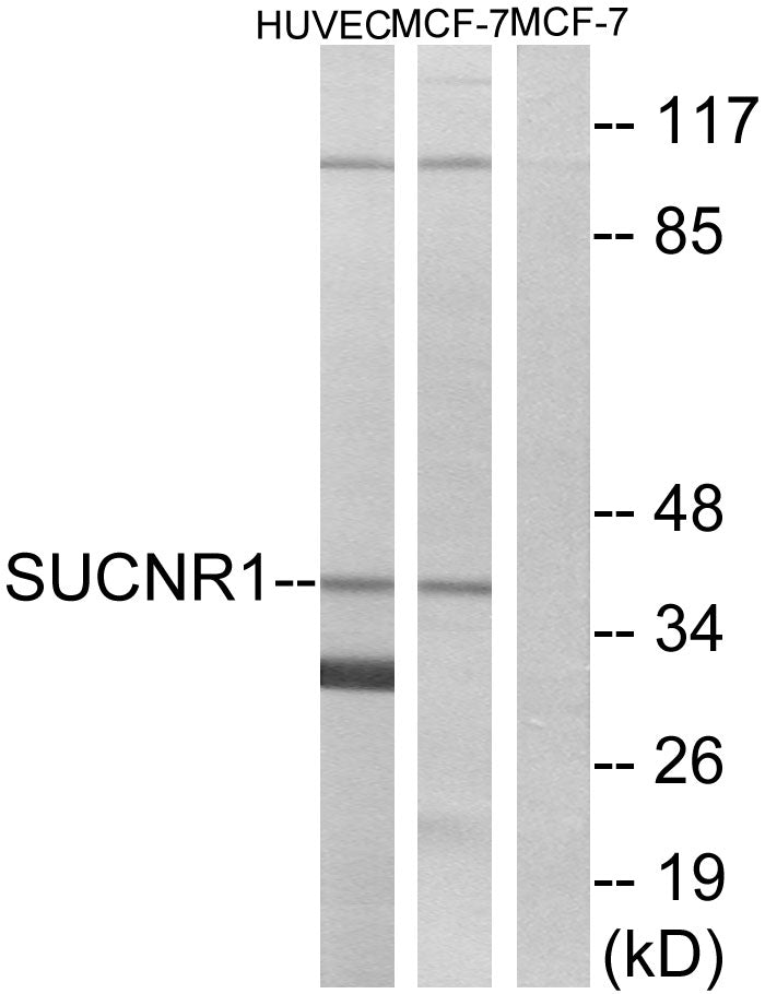 GPR91 Rabbit Polyclonal Antibody
