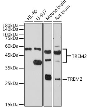 TREM2 Rabbit Polyclonal Antibody