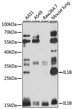 IL-1 beta Rabbit Polyclonal Antibody