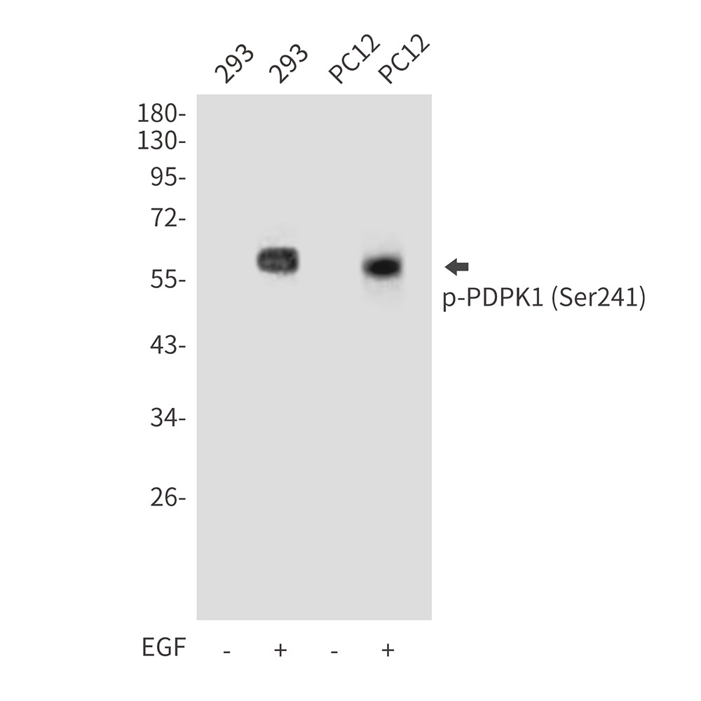 Phospho-PDPK1 (Ser241) Rabbit Polyclonal Antibody