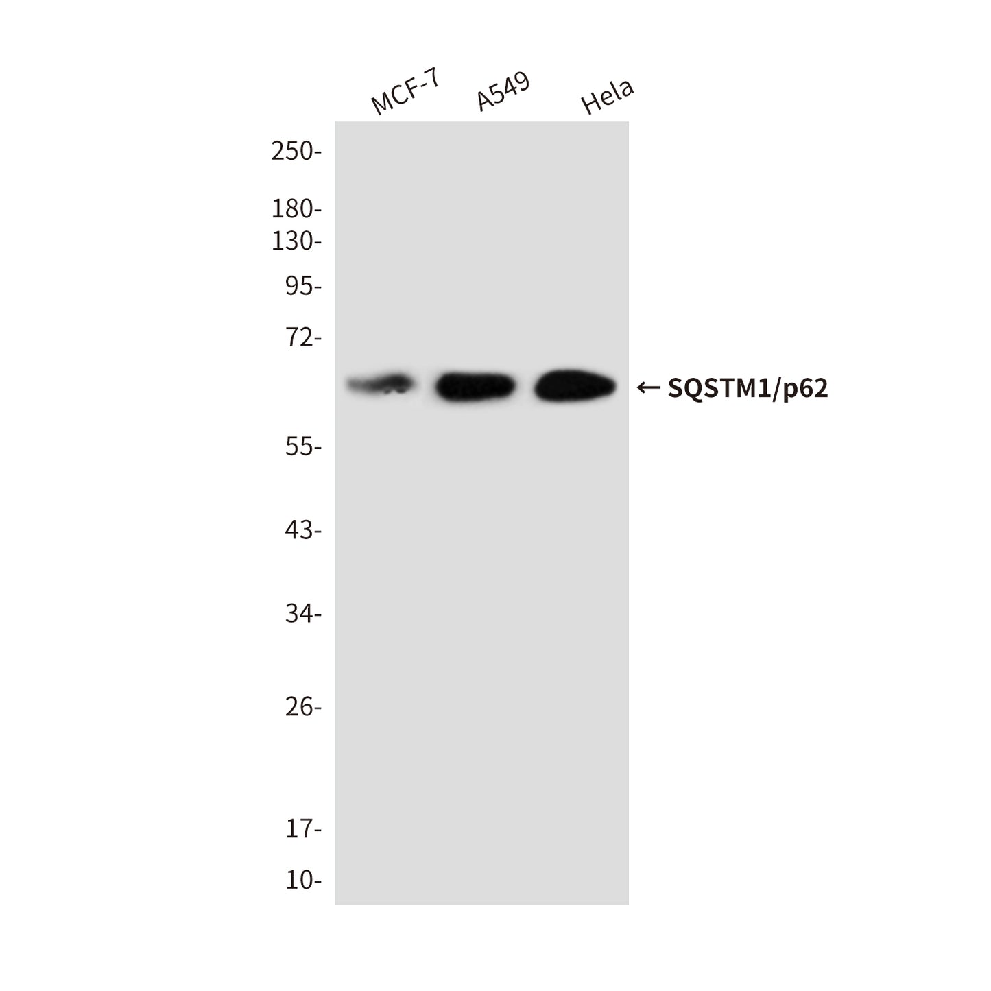 SQSTM1/p62 Rabbit Polyclonal Antibody
