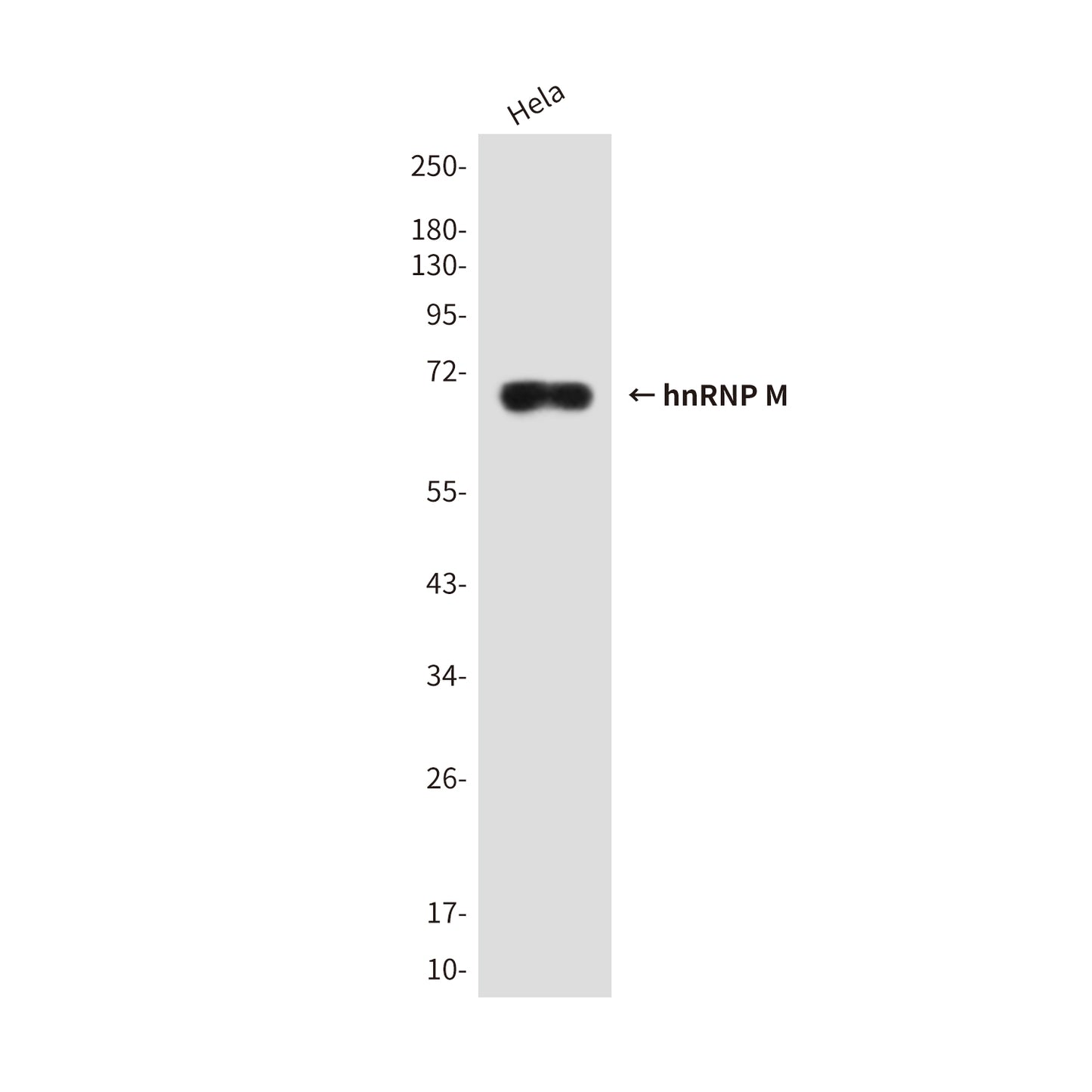 hnRNP M Rabbit Polyclonal Antibody