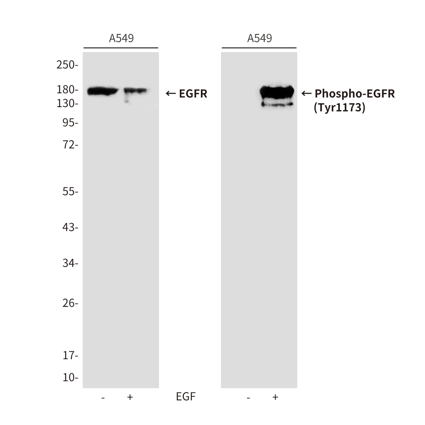Phospho-EGFR (Tyr1173) Rabbit Polyclonal Antibody