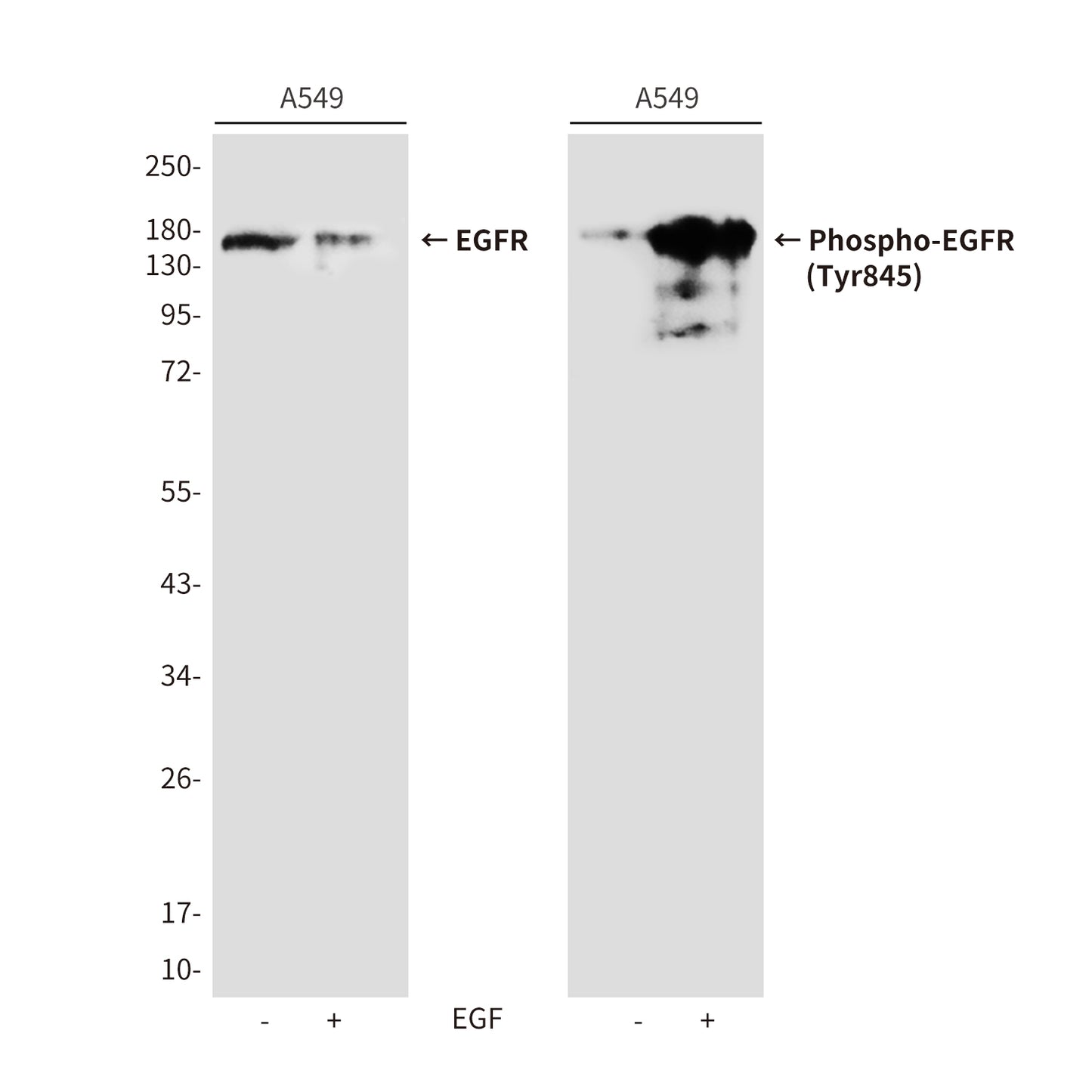 Phospho-EGFR (Tyr845) Rabbit Polyclonal Antibody
