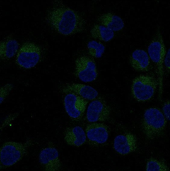 NF-KB p65 Rabbit Polyclonal Antibody