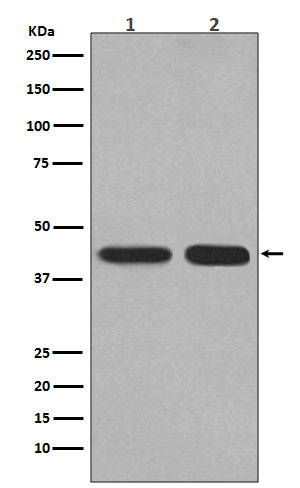 PGK1 Rabbit Polyclonal Antibody