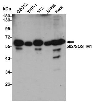 SQSTM1/p62 Rabbit Polyclonal Antibody