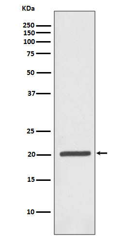 Ferritin Heavy Chain Rabbit Polyclonal Antibody