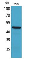 FOXP3 Rabbit Polyclonal Antibody