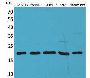 VEGFA Rabbit Polyclonal Antibody
