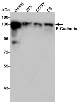 E Cadherin Rabbit Polyclonal Antibody