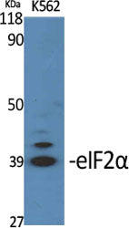 eIF2A Rabbit Polyclonal Antibody