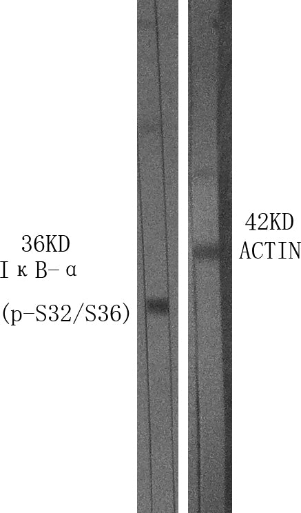 Phospho-IKB alpha (Ser32/Ser36) Rabbit Polyclonal Antibody