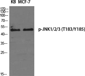 Phospho-JNK (Thr183/Tyr185) Rabbit Polyclonal Antibody
