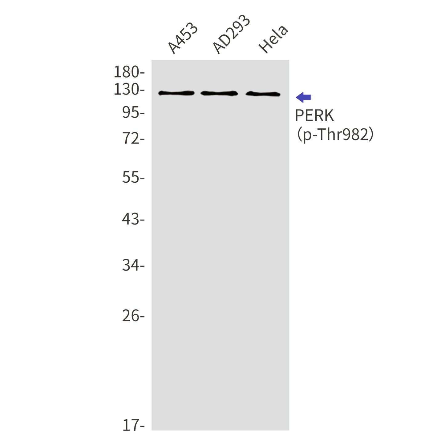 Phospho-PERK (Thr982) Rabbit Polyclonal Antibody