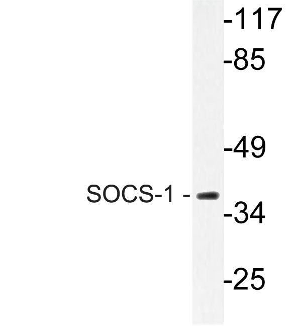 SOCS1 Rabbit Polyclonal Antibody