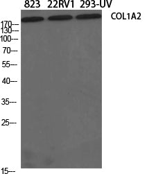 Collagen I alpha 2 Rabbit Polyclonal Antibody
