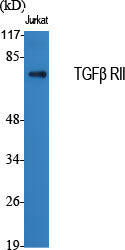 TGF beta Receptor II Rabbit Polyclonal Antibody