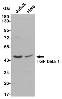 TGF beta 1 Rabbit Polyclonal Antibody