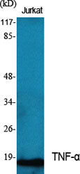 TNF alpha Rabbit Polyclonal Antibody