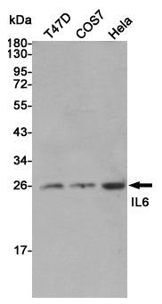 IL-6 Rabbit Polyclonal Antibody