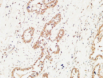 c-Kit Rabbit Polyclonal Antibody