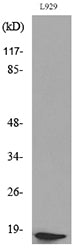 Acetyl eIF5A/eIF5A2 (K47) Rabbit Polyclonal Antibody