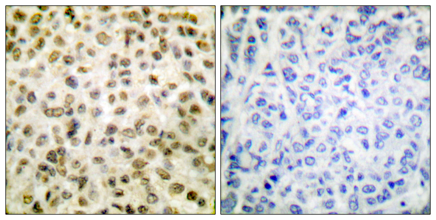 Acetyl Histone H1 (K25) Rabbit Polyclonal Antibody