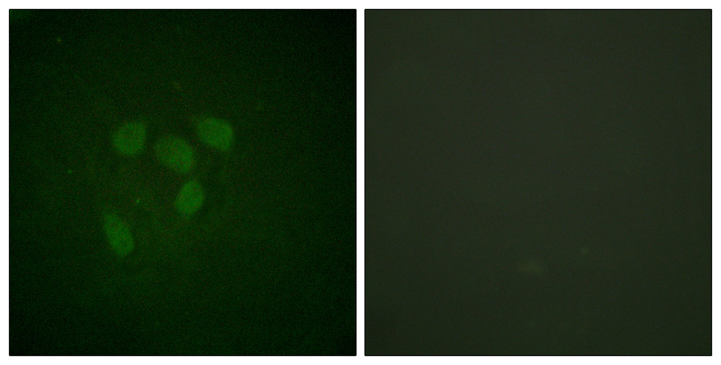 Acetyl p53 (K319) Rabbit Polyclonal Antibody