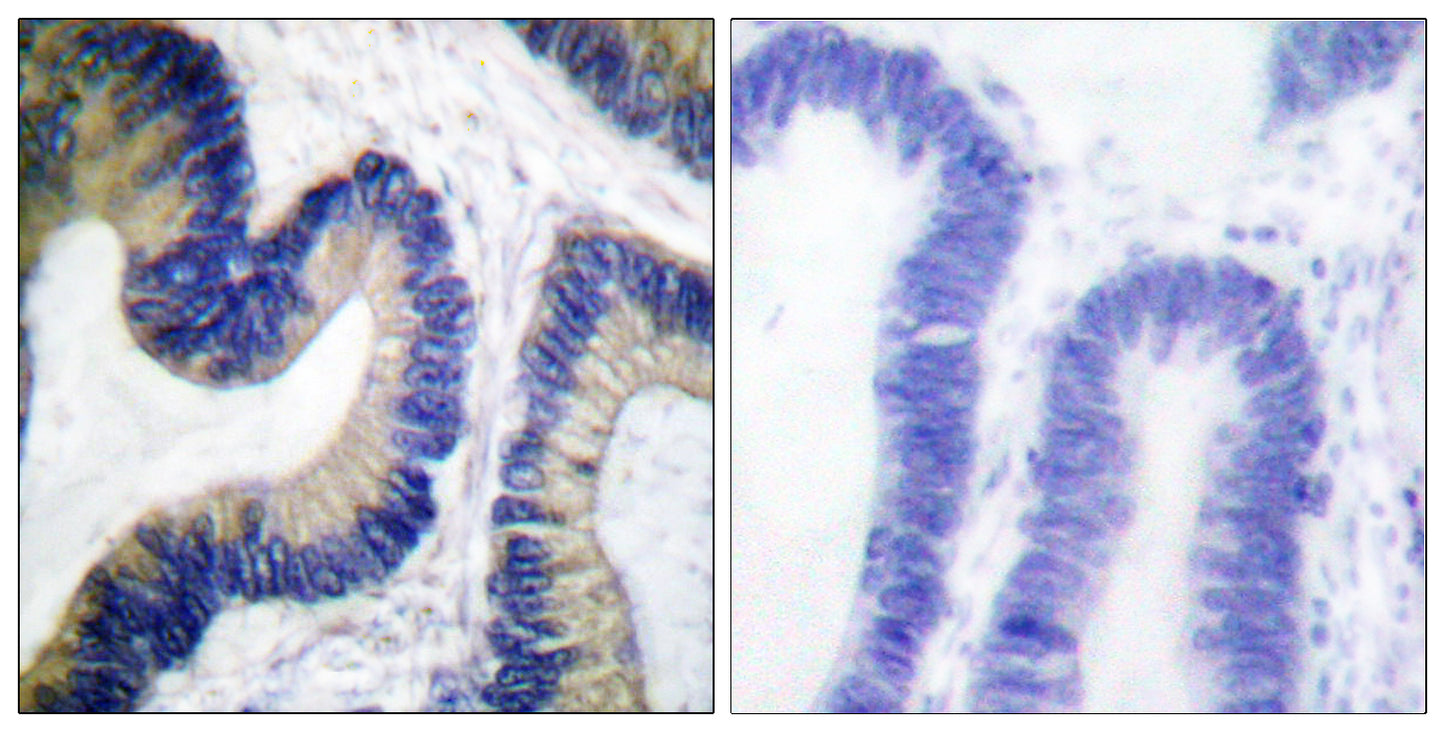 4E-BP1 (phospho Ser65) Rabbit Polyclonal Antibody