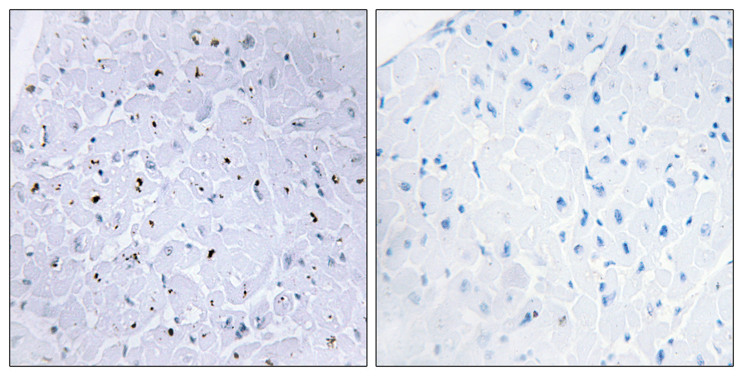 53BP1 (phospho Ser6) Rabbit Polyclonal Antibody