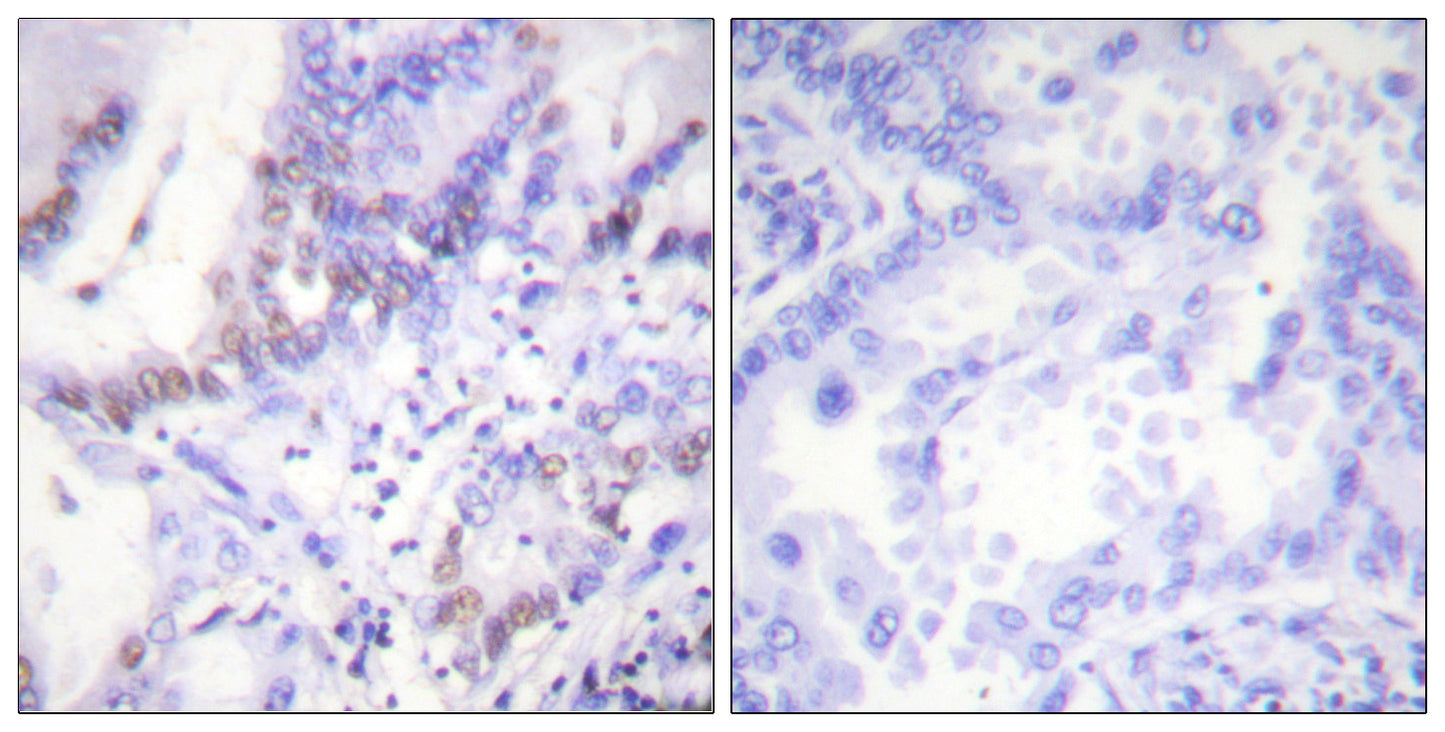 Abl1/2 (phospho Tyr393/439) Rabbit Polyclonal Antibody