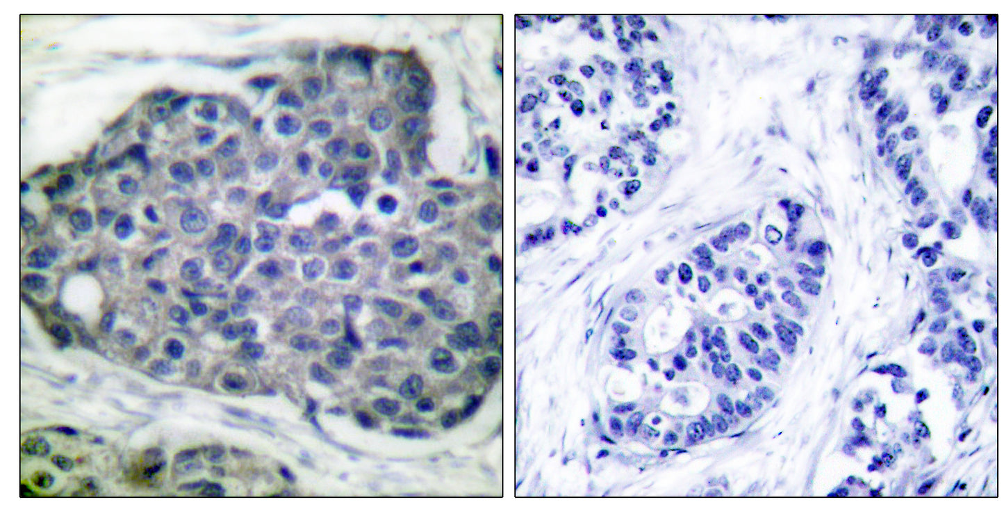 ACCα (phospho Ser80) Rabbit Polyclonal Antibody