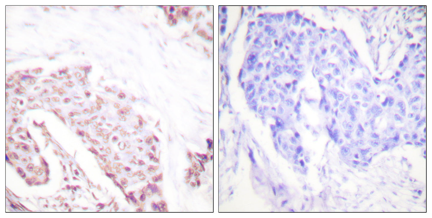 Akt (phospho Ser124) Rabbit Polyclonal Antibody