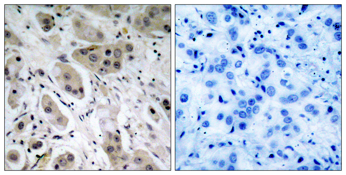 Akt (phospho Ser473) Rabbit Polyclonal Antibody