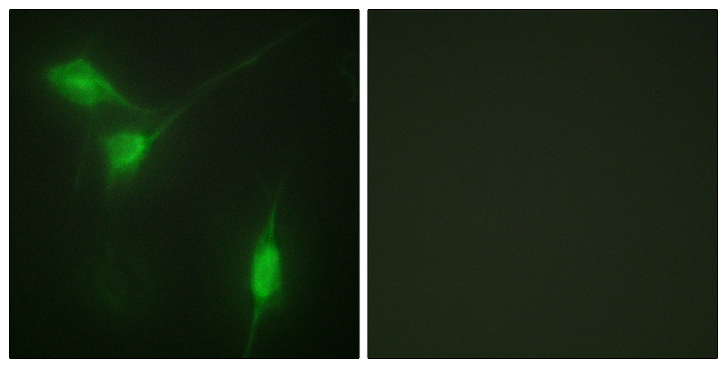 Akt1 (phospho Ser246) Rabbit Polyclonal Antibody