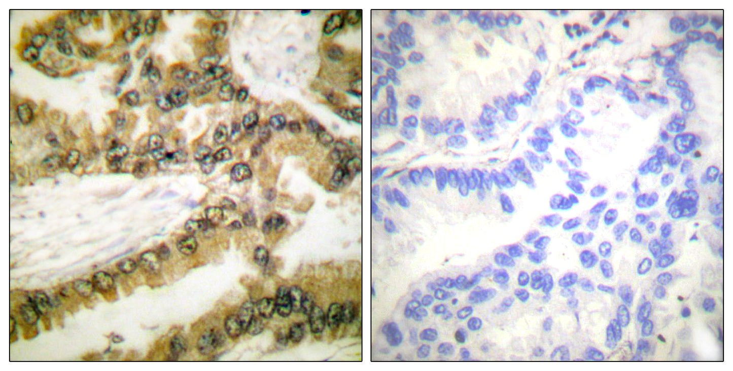 Akt1 (phospho Thr450) Rabbit Polyclonal Antibody