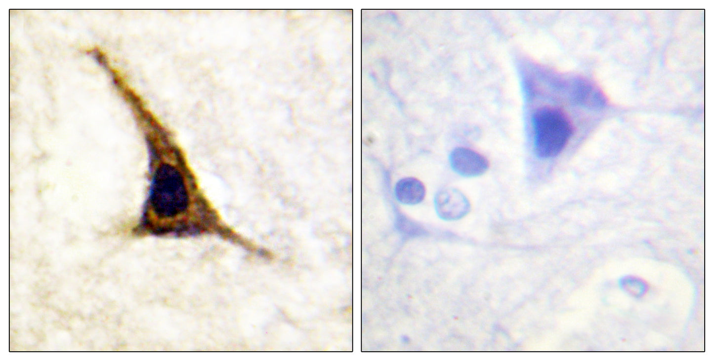 AR-β2 (phospho Ser355/S356) Rabbit Polyclonal Antibody