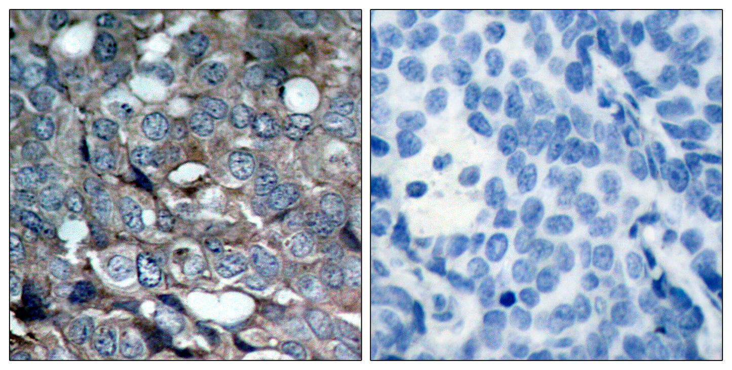 ASK 1 (phospho Ser83) Rabbit Polyclonal Antibody