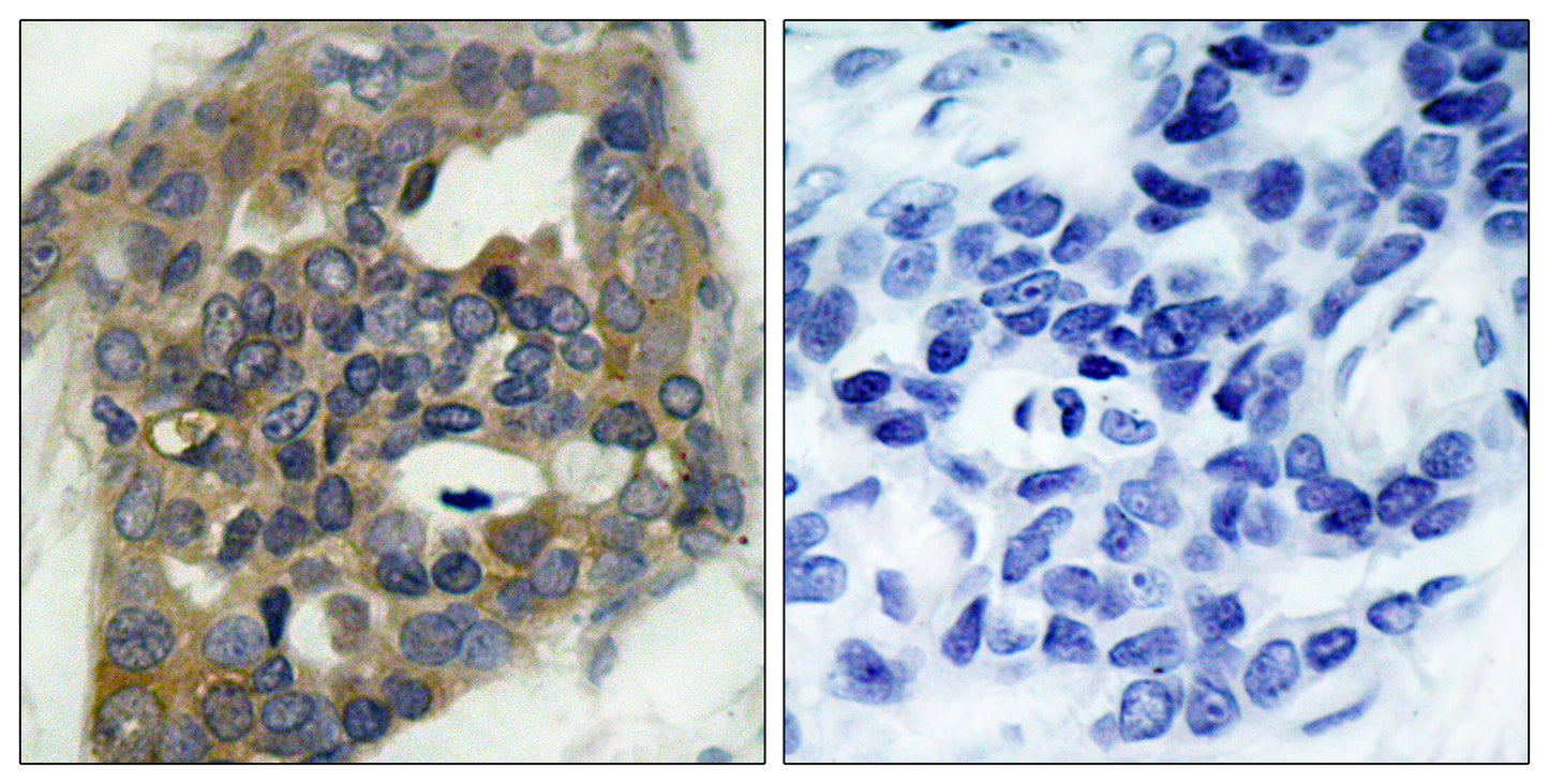 ASK 1 (phospho Ser966) Rabbit Polyclonal Antibody