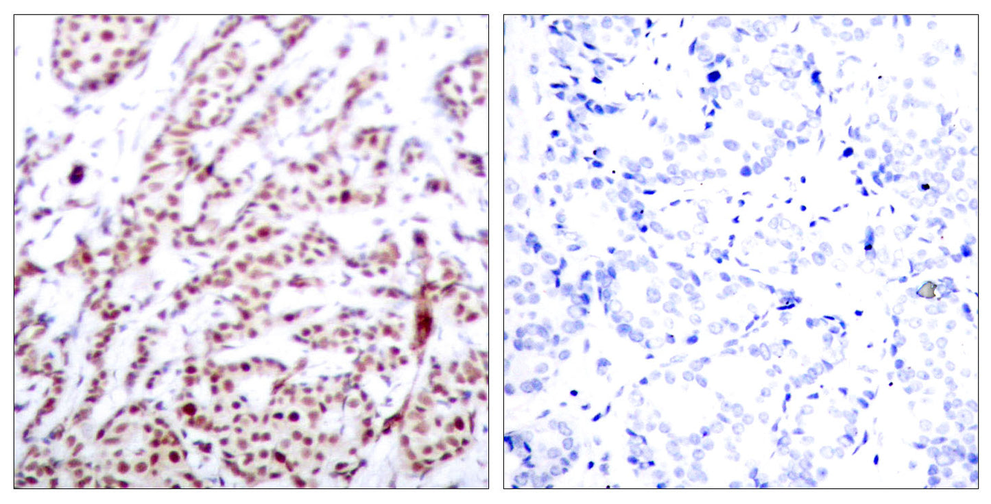 ATF-2 (phospho Thr73) Rabbit Polyclonal Antibody