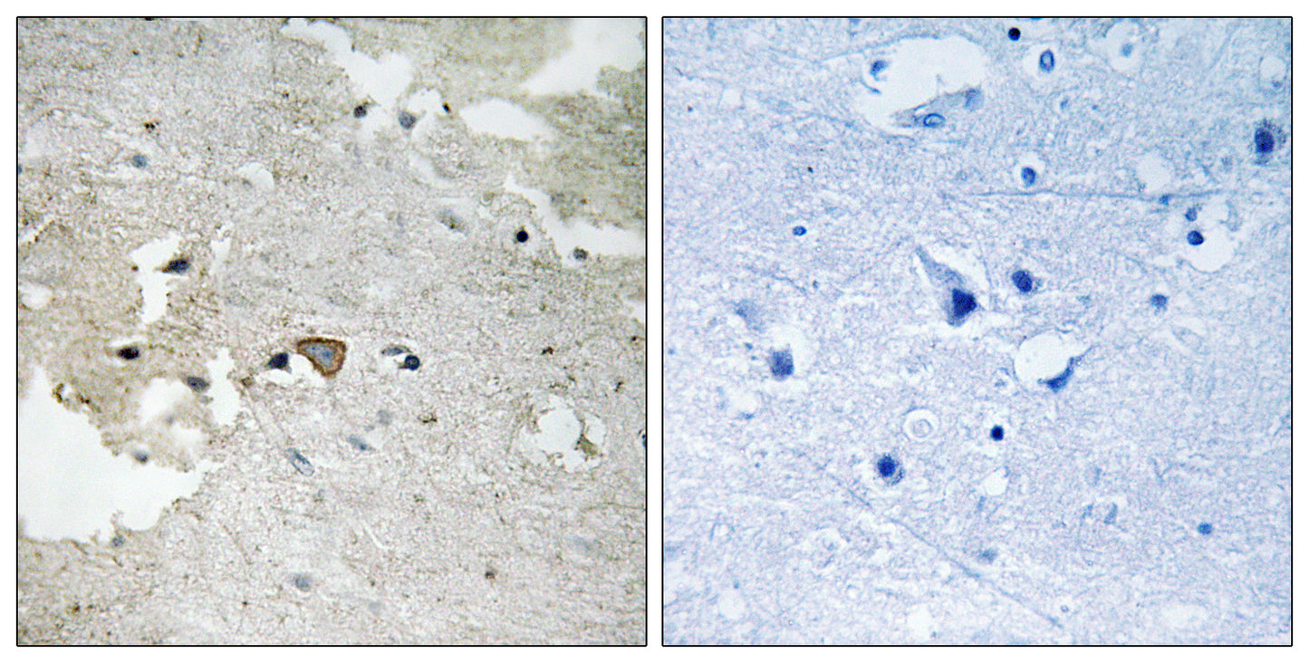 Axl (phospho Tyr691) Rabbit Polyclonal Antibody