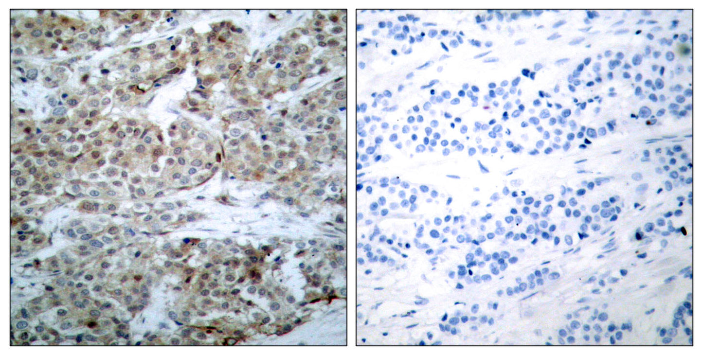 Bad (phospho Ser112) Rabbit Polyclonal Antibody