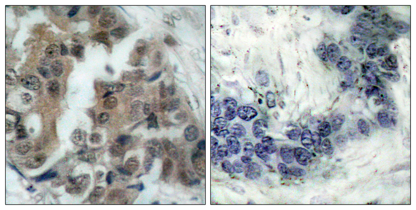 Bad (phospho Ser136) Rabbit Polyclonal Antibody