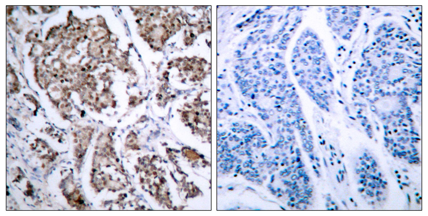 Bad (phospho Ser155) Rabbit Polyclonal Antibody