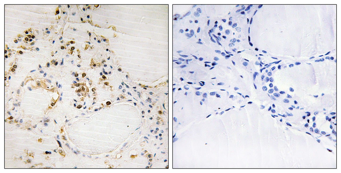 Bcl-2 (phospho Ser87) Rabbit Polyclonal Antibody