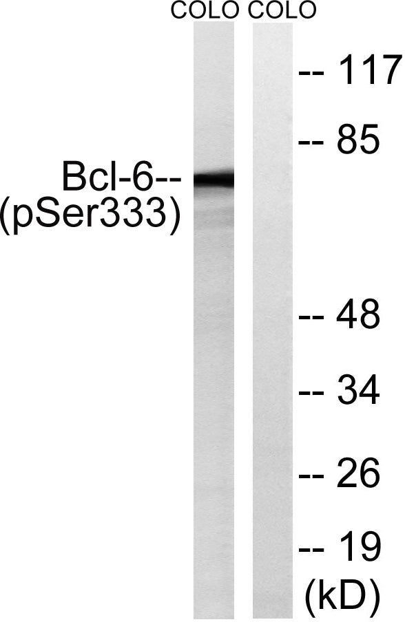 Bcl-6 (phospho Ser333) Rabbit Polyclonal Antibody